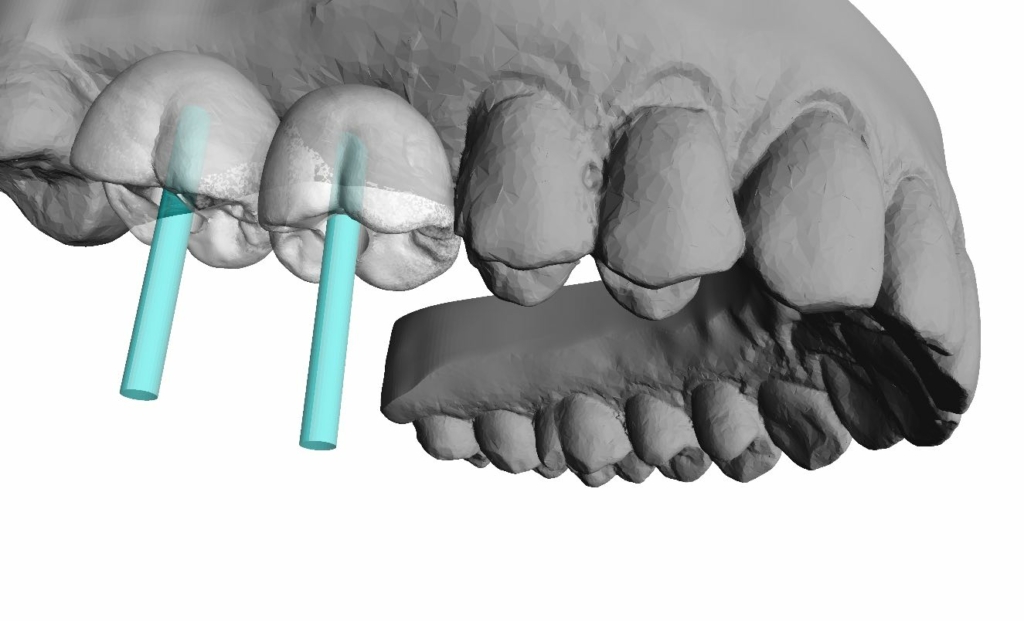 Imagen visor 3D BiteRight Imagen visor 3D BiteRight
