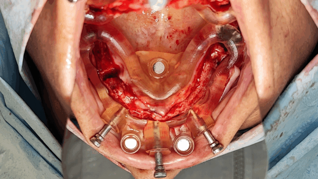 Caso Clínico - Cirugía