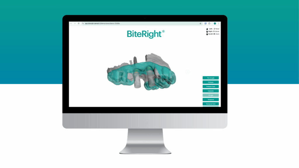 Plataforma de Implantología de alta precisión de BiteRight - BRDP