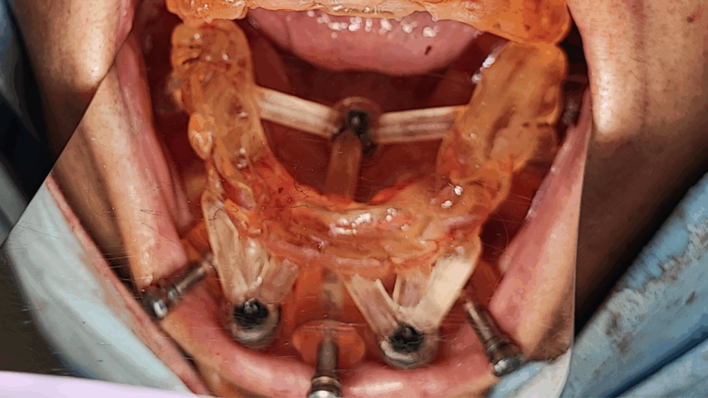 Caso Clínico - Cirugía