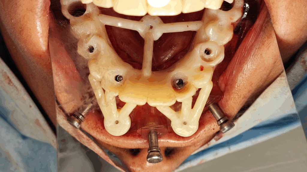 Caso Clínico - Cirugía