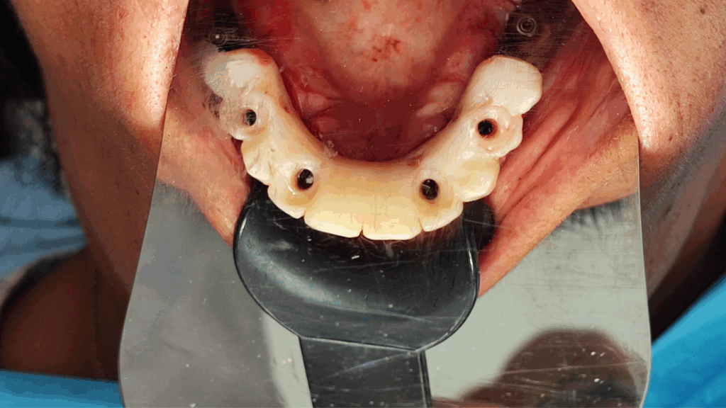 Caso Clínico - Cirugía